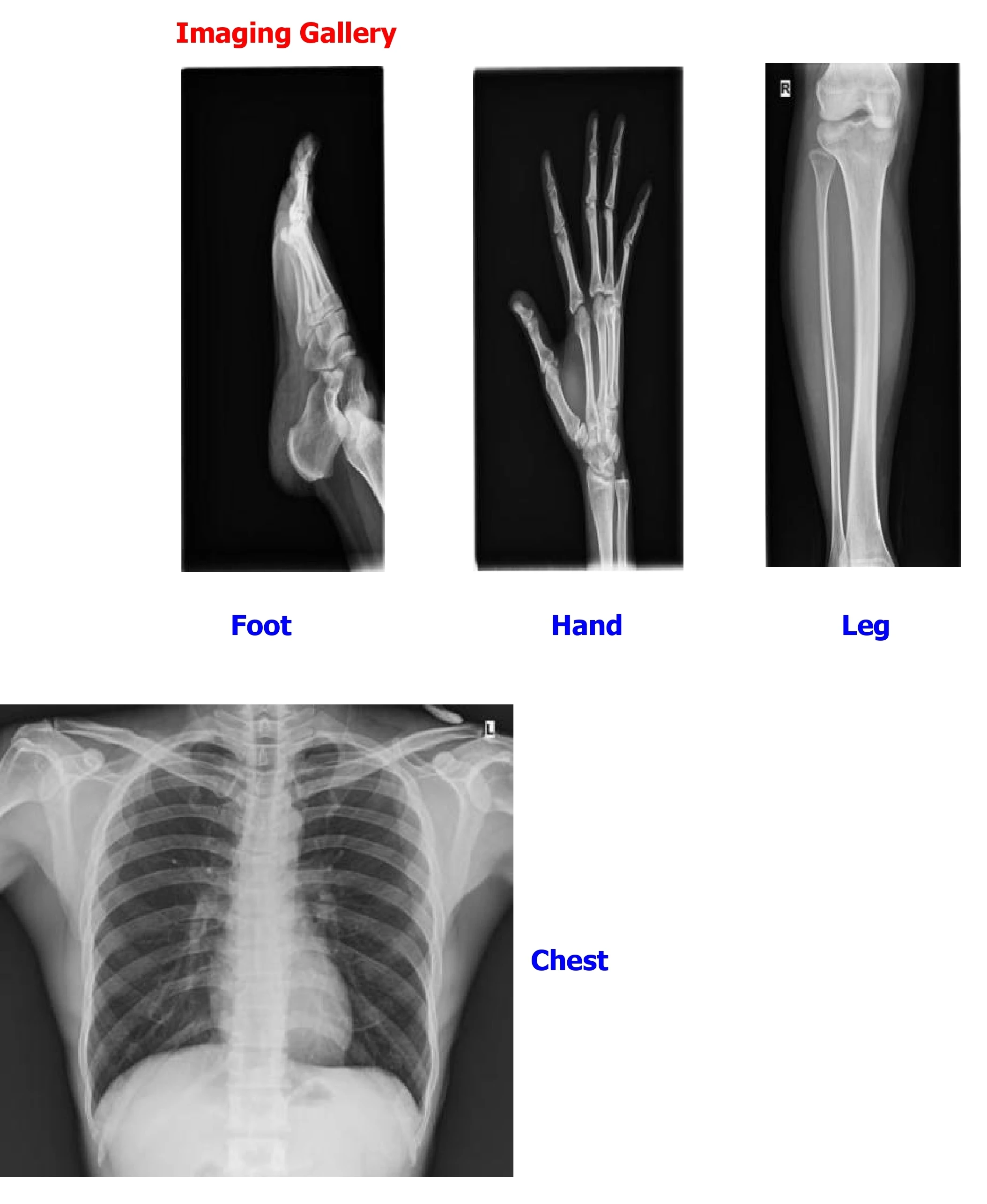 Apparecchiatura radiologica mo - X Medical Lab recensione e prezzo